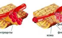 Как убрать фибриновый налет из раны